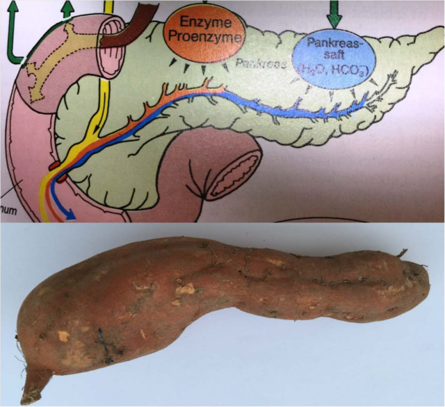 pancreas-scan-johns-hopkins-medicine